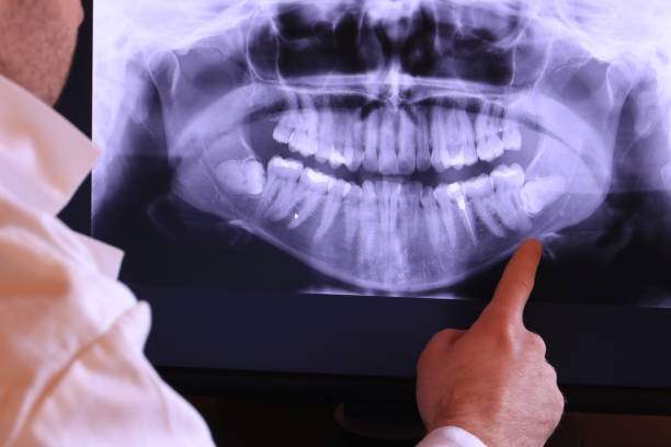 Best Emergency Root Canal Treatment in Jones, OK