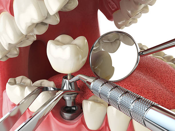 Best Pediatric Emergency Dentist in Jones, OK